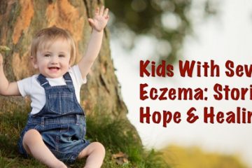 Stories of healing for kids with severe eczema