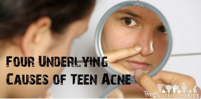 causes of teen acne